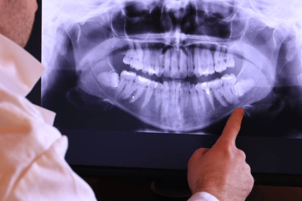 Best Cracked Tooth Emergency Dentist  in Redding, CA